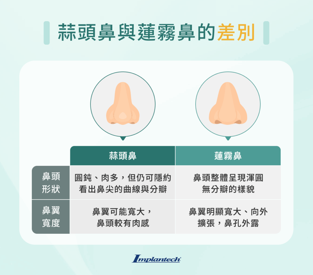 蒜頭鼻的最佳解決方案是什麼？從微整到隆鼻手術的4種方法說明 - Lyra Implantech